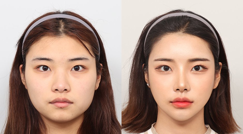 หน้าเรียวแบบธรรมชาติ เกาหลี
