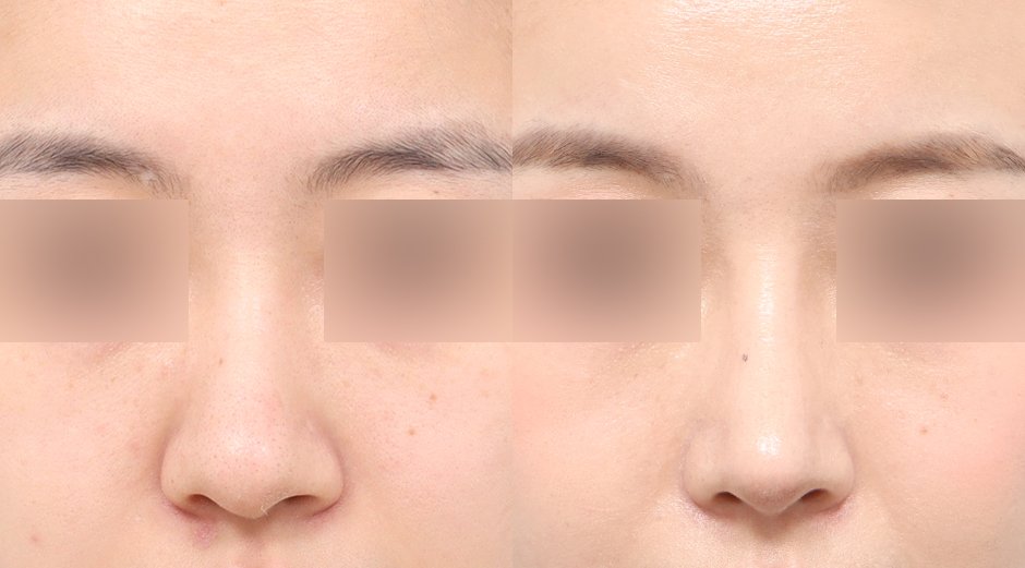 หน้าเรียวแบบธรรมชาติ เกาหลี