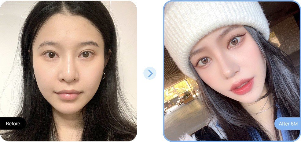 หน้าเรียว