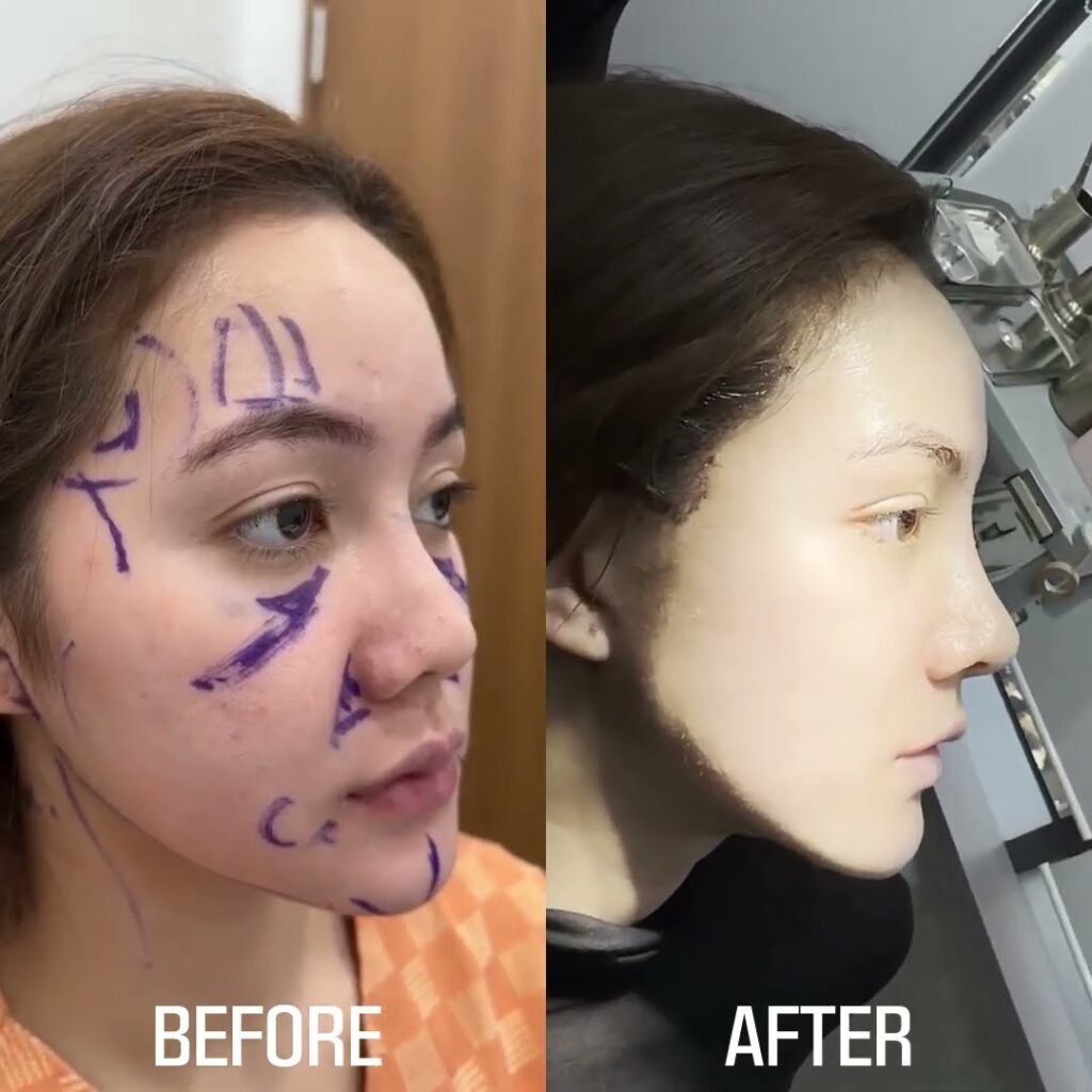 บล็อกศัลยกรรมเกาหลี