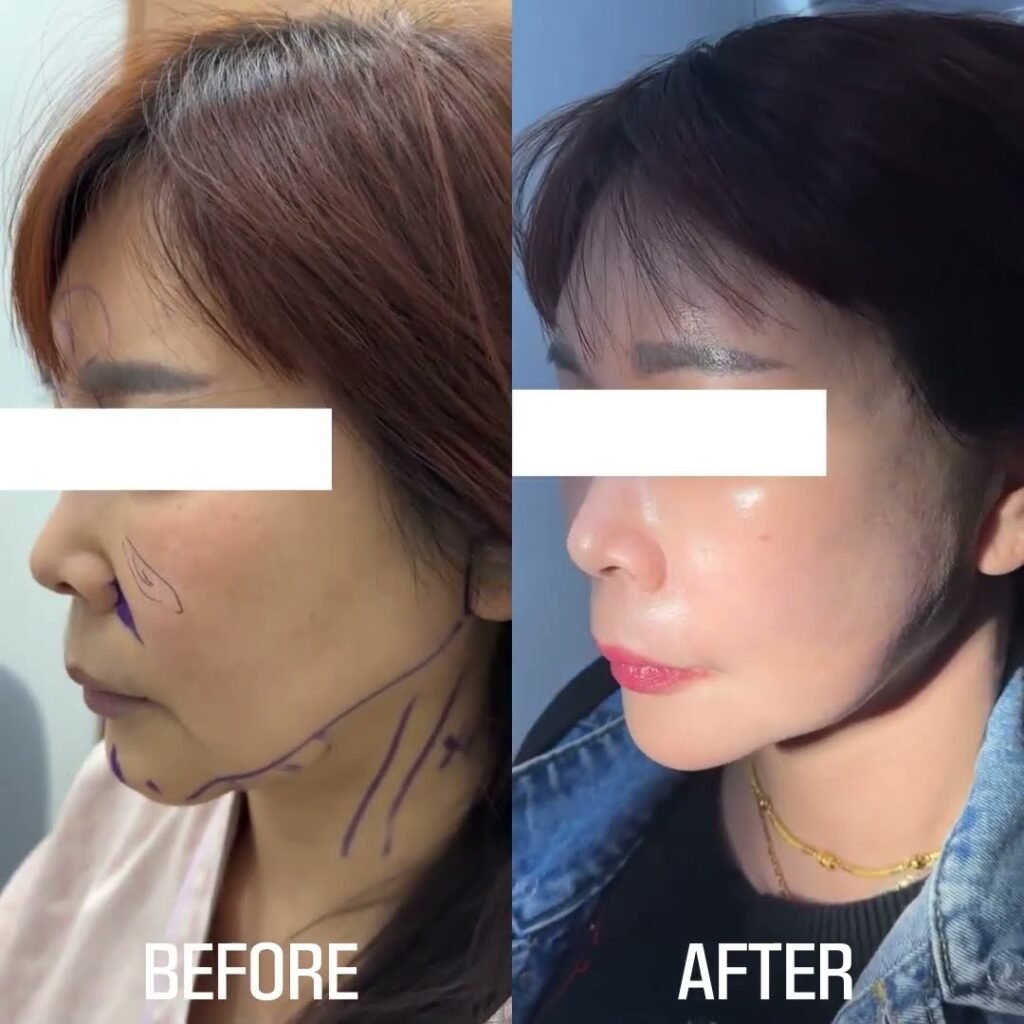 แพ็กเกจศัลยกรรมสุดคุ้ม